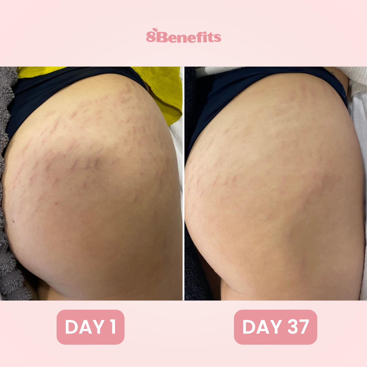7-in-1 Skin Complex Gummies