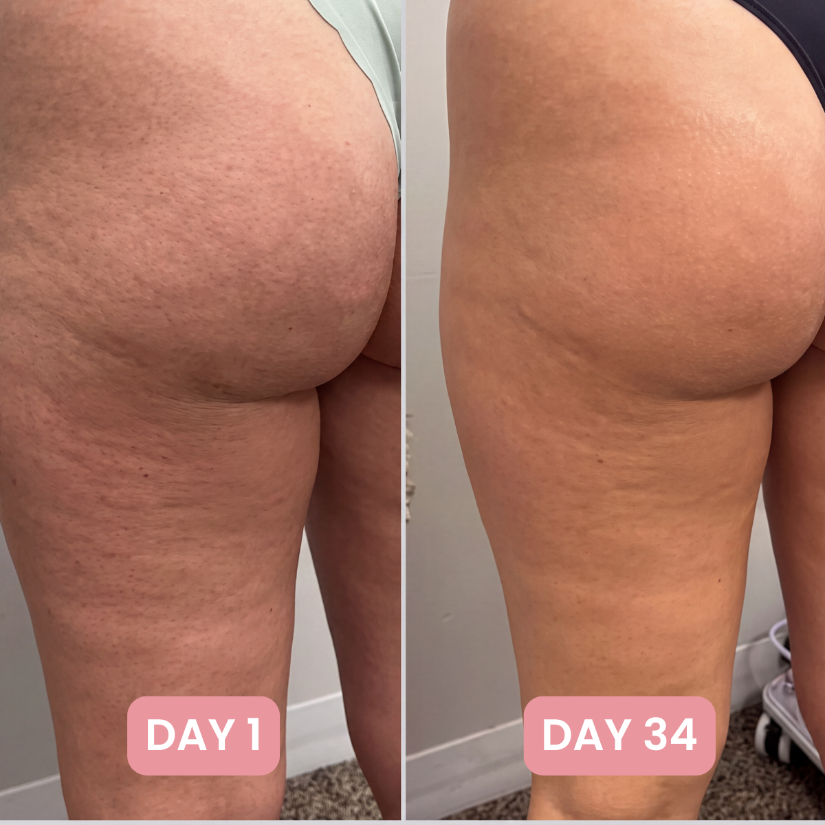7-in-1 Skin Complex Gummies