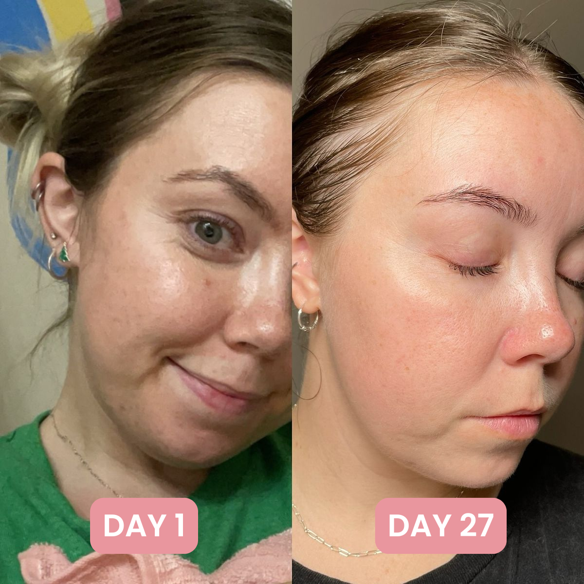 7-in-1 Skin Complex Gummies