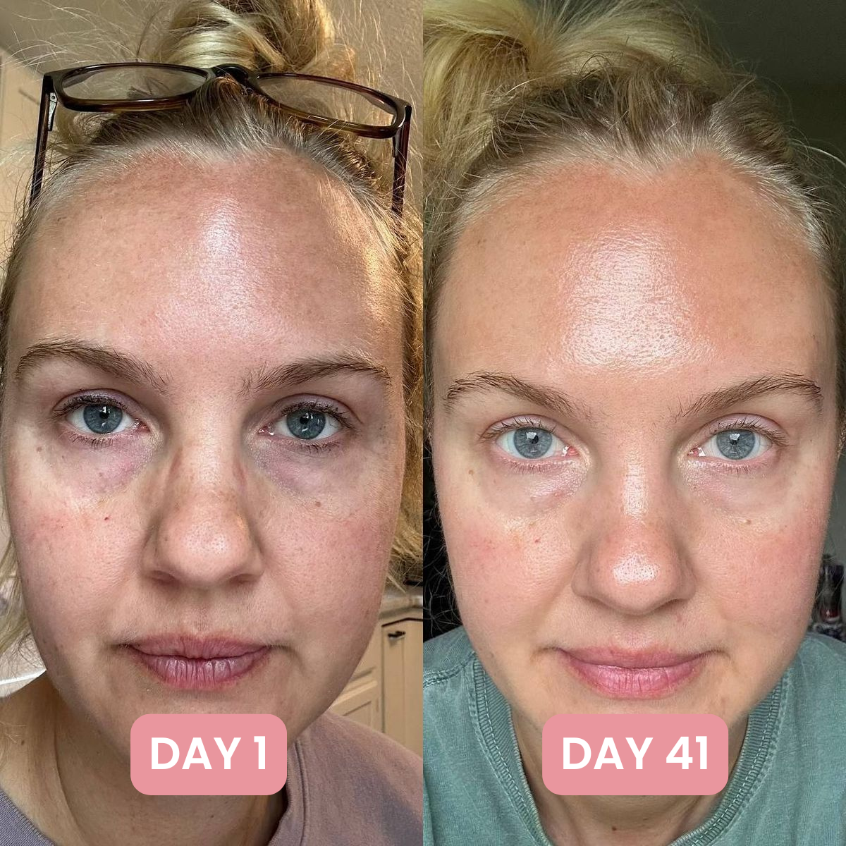 7-in-1 Skin Complex Gummies