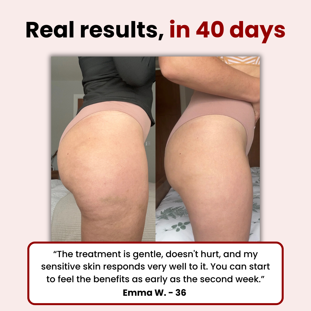 ZeloraLab™ Anti-Cellulite & Fat-Burning Massager