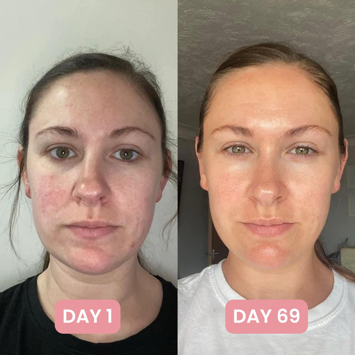7-in-1 Skin Complex Gummies