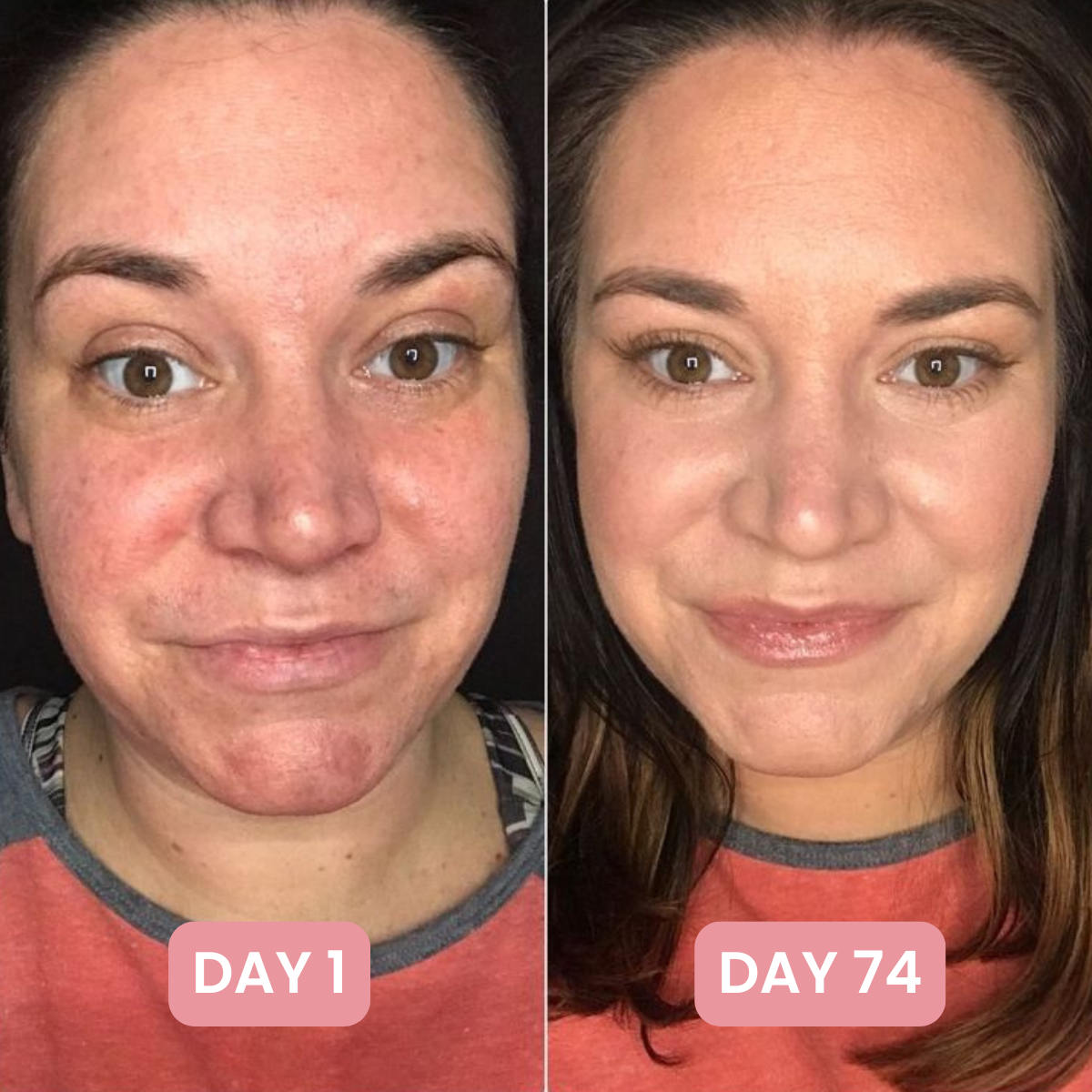 7-in-1 Skin Complex Gummies